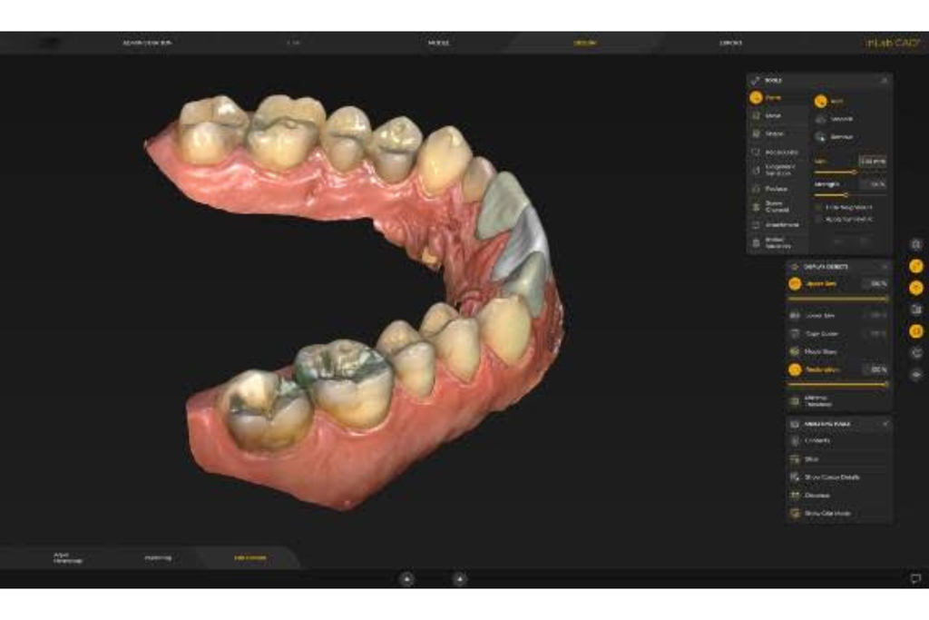 inLab dental CAD software showing a 3D model of teeth and gums with restoration design controls and adjustment settings.